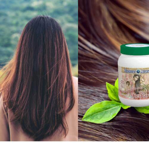 zdravé vlasy Everest Ayurveda